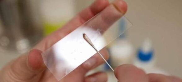 Škrábání vajíček červů